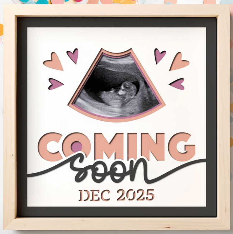 Coming Soon Ultrasound Photo Frame Kit